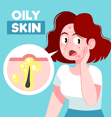 What are Freckles and How to Get Rid of Them